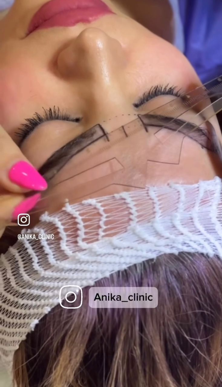 کاشت پر تراکم ابرو !